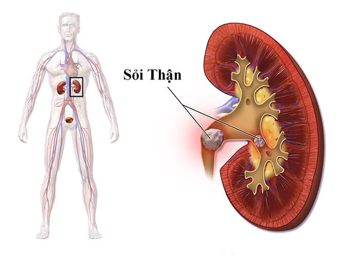 Tác dụng chữa bệnh của cây kim tiền thảo